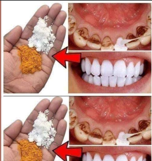 CLAREAR OS DENTES EM 2 MINUTOS