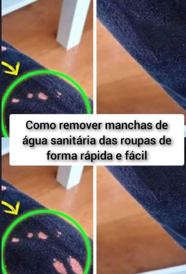 como remover mancha de agua sanitária de roupas