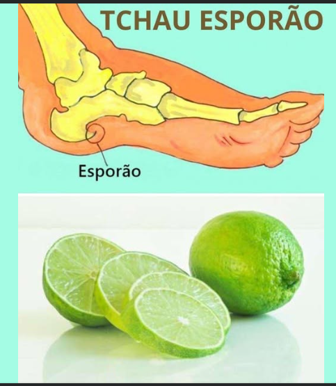 RECEITA CASEIRA PARA ESPORÃO COM LIMÃO