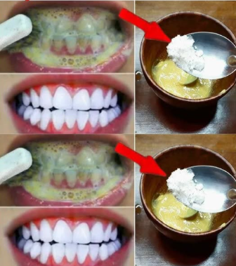 CLAREAR DENTE EM CASA